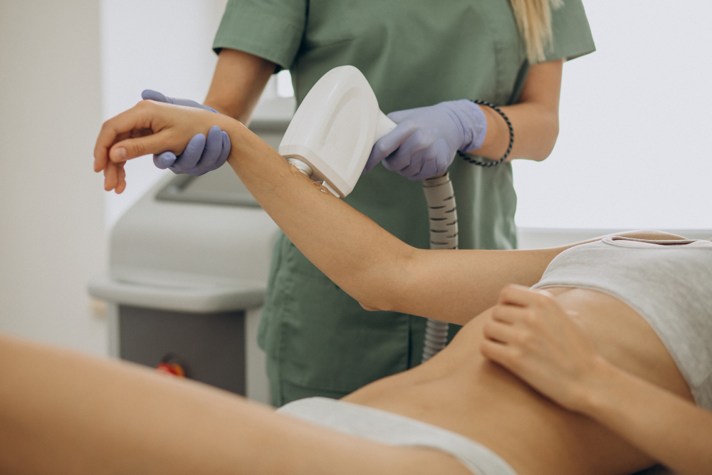 seance epilation laser