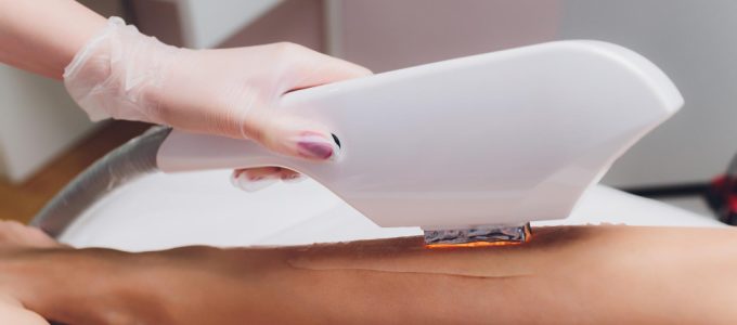 epilation laser depilinea